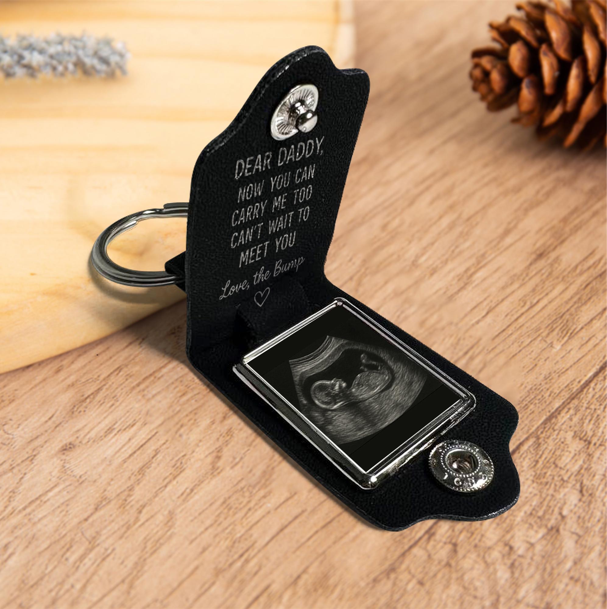 Custom Ultrasound Leather Photo Keychain | Dear Daddy Gift from Bump | Pregnancy Reveal Keepsake | First Father’s Day Key Ring